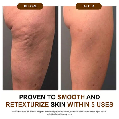 ✅𝐙𝐯𝐨𝐞𝐯𝐨® 𝐒𝐢𝐥𝐤 𝐁𝐨𝐝𝐲 𝐎𝐢𝐥🔥𝐌𝐇𝐑𝐀-𝐀𝐏𝐏𝐑𝐎𝐕𝐄𝐃 – Firms, Lifts & Smooths the Skin, Reduces Wrinkles, and Restores Youthful Elasticity