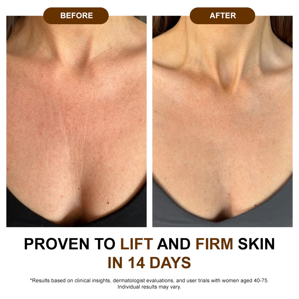 ✅𝐙𝐯𝐨𝐞𝐯𝐨® 𝐒𝐢𝐥𝐤 𝐁𝐨𝐝𝐲 𝐎𝐢𝐥🔥𝐌𝐇𝐑𝐀-𝐀𝐏𝐏𝐑𝐎𝐕𝐄𝐃 – Firms, Lifts & Smooths the Skin, Reduces Wrinkles, and Restores Youthful Elasticity