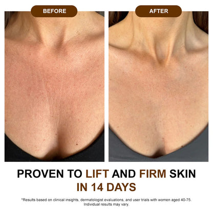 ✅𝐙𝐯𝐨𝐞𝐯𝐨® 𝐒𝐢𝐥𝐤 𝐁𝐨𝐝𝐲 𝐎𝐢𝐥🔥𝐌𝐇𝐑𝐀-𝐀𝐏𝐏𝐑𝐎𝐕𝐄𝐃 – Firms, Lifts & Smooths the Skin, Reduces Wrinkles, and Restores Youthful Elasticity