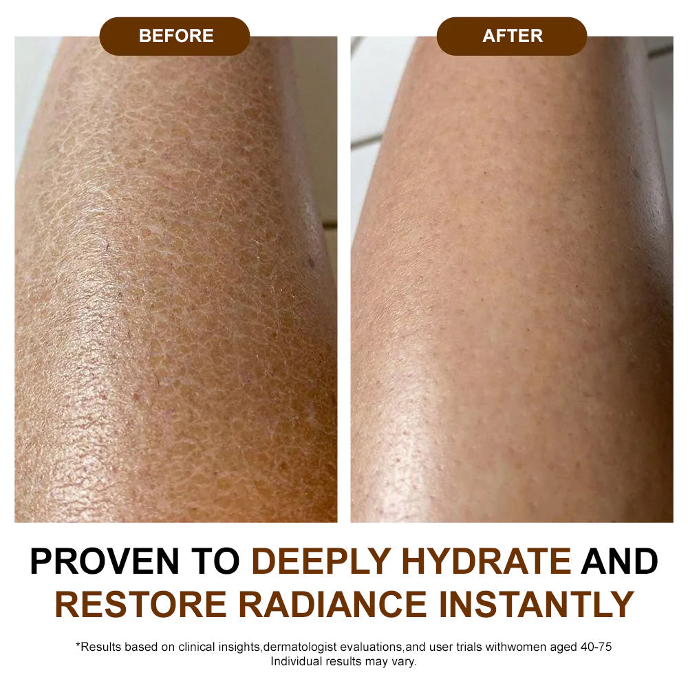 ✅𝐙𝐯𝐨𝐞𝐯𝐨® 𝐒𝐢𝐥𝐤 𝐁𝐨𝐝𝐲 𝐎𝐢𝐥🔥𝐌𝐇𝐑𝐀-𝐀𝐏𝐏𝐑𝐎𝐕𝐄𝐃 – Firms, Lifts & Smooths the Skin, Reduces Wrinkles, and Restores Youthful Elasticity